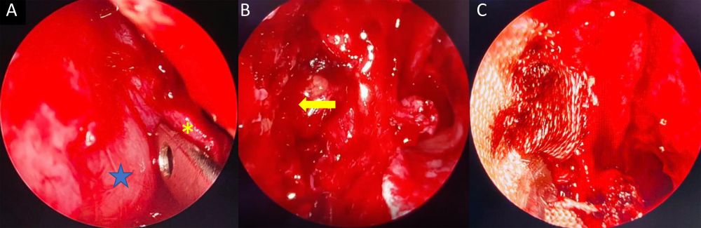 A close up of a red objectDescription automatically generated